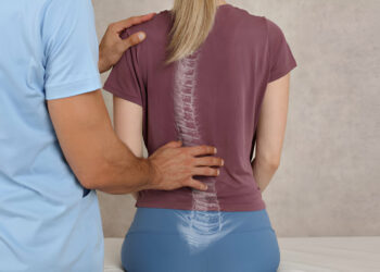 Scoliosis