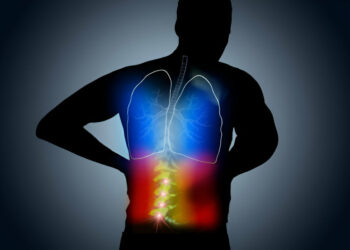 Scoliosis Spectrum