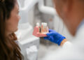 dental implants