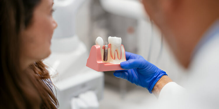 dental implants